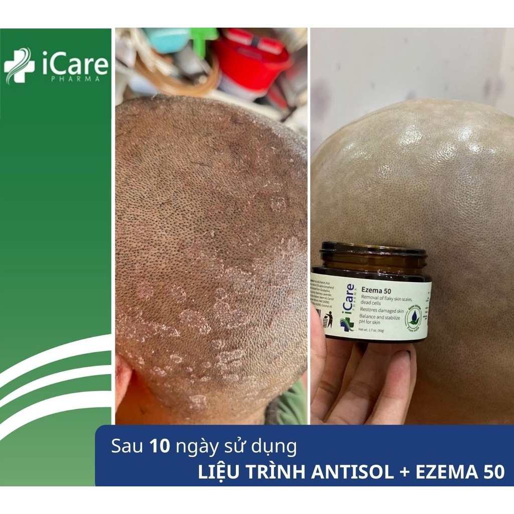 Combo Dầu Gội Trị Gàu Antisol + 1 Kem Ủ Enzema50 3 combo-dau-goi-antisol-kem-u-enzema50