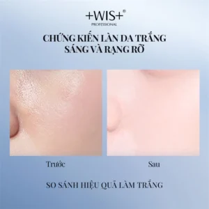 serum-duong-am-wis