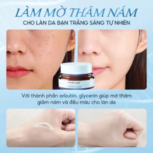 kem-duong-da-fresh-lady-ho-tro-mo-tham-giam-nam