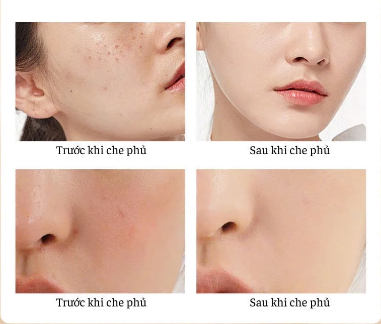 Kem Nền Katelyn Che Khuyết Điểm 4 In 1 6 kem-nen-katelyn-che-khuyet-diem-4-in-1