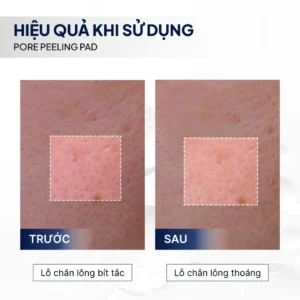 Tẩy da chết BHA Pore Peeling Pad LUBYLAB 11 tay-da-chet-bha-pore-peeling-pad-lubylab
